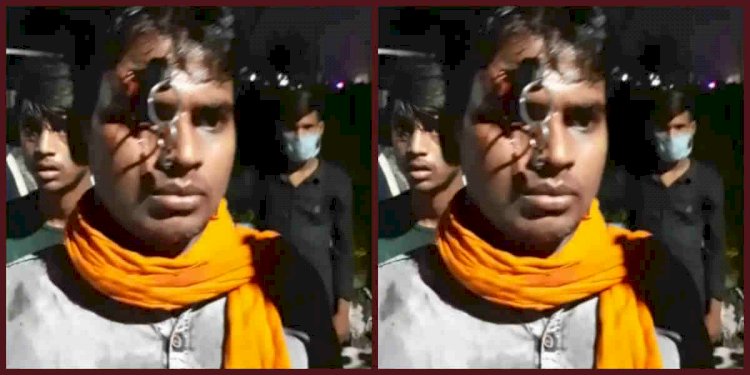 रुद्रपुर: चेकिंग के दौरान सीपीयू कर्मी ने घोंप दी बाइक सवार के माथे पर चाबी
